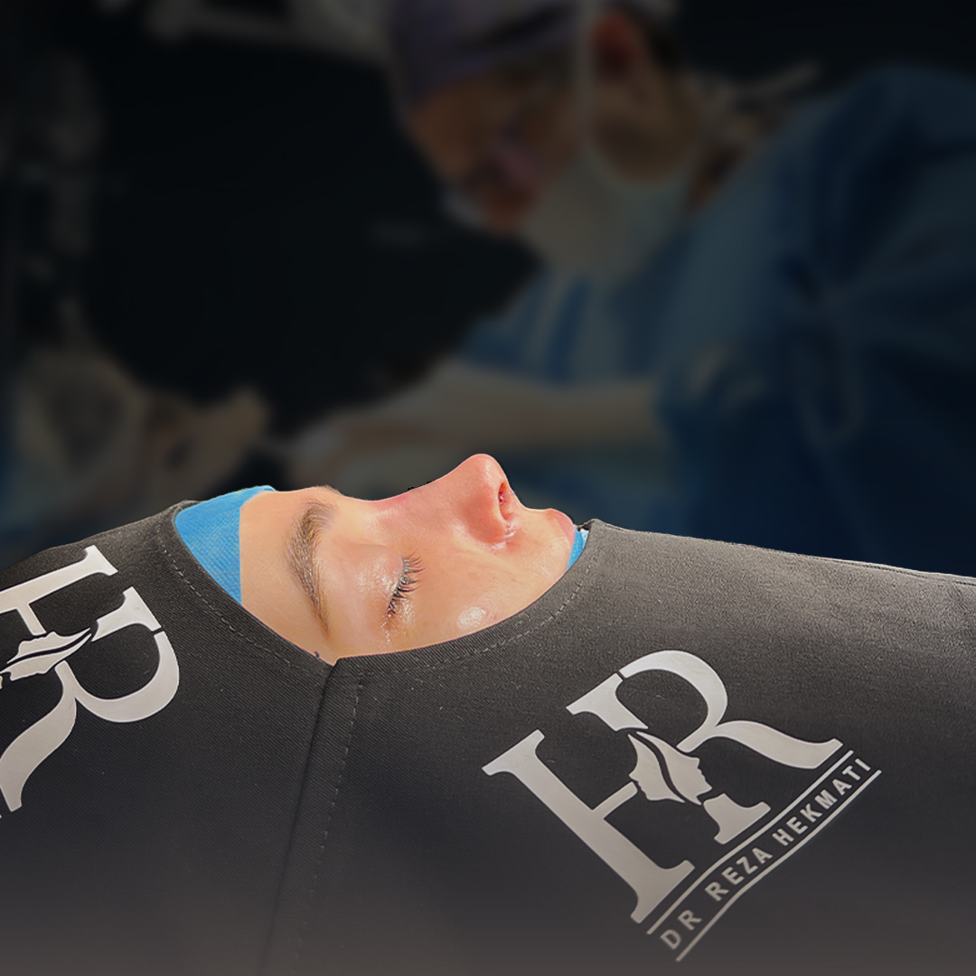 تجمیل الأنف - بعد از درمان